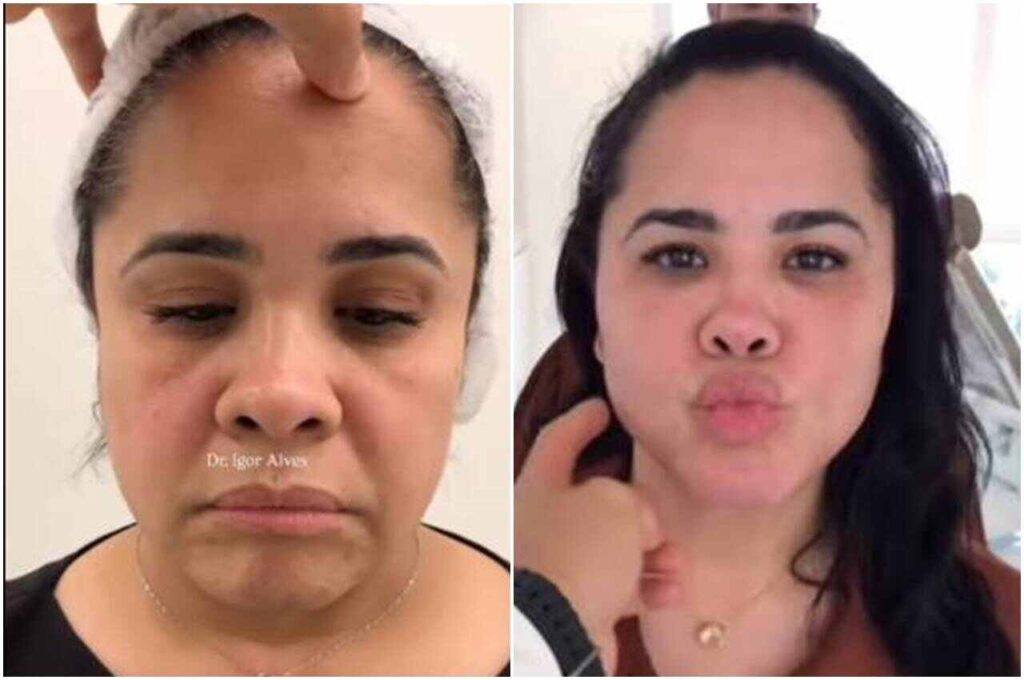 Cassiane surpreende seguidores com transformação estética aos 52 anos
